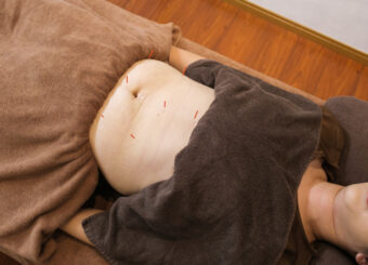 美腸鍼＋全身骨格矯正